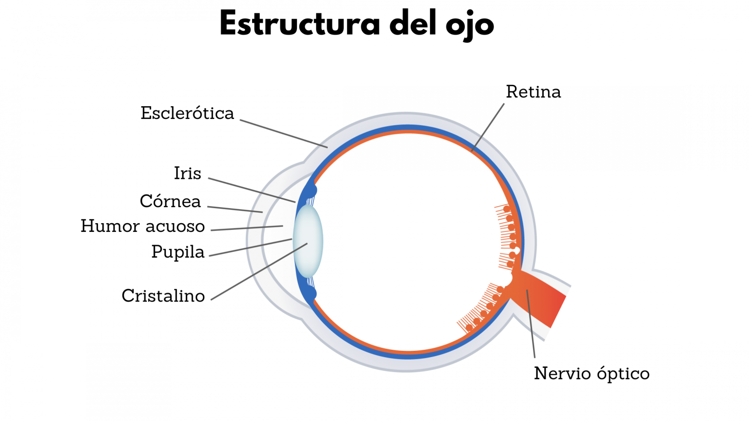 Esquema comparativo de distintos errores refractivos